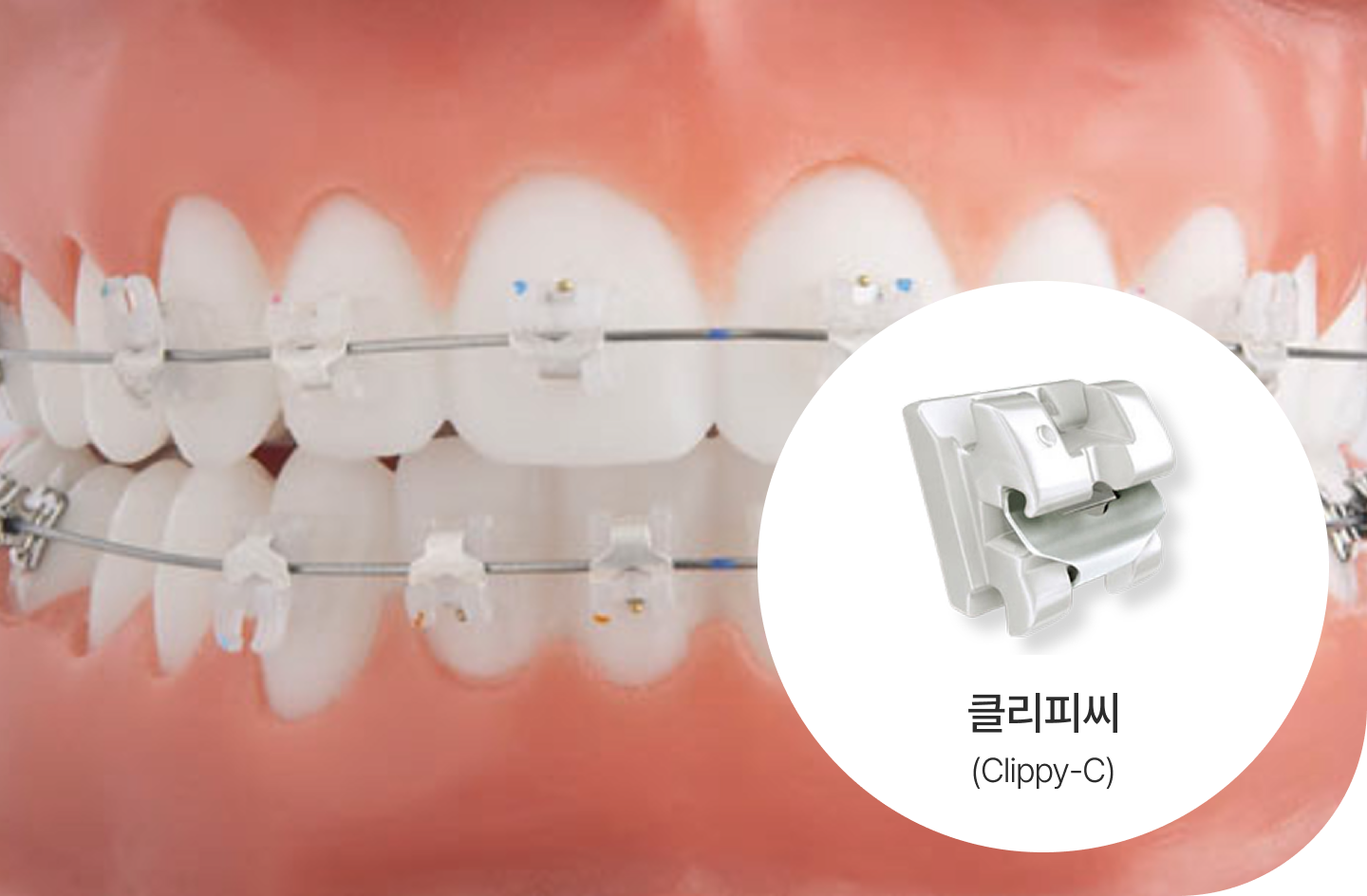 클리피씨교정