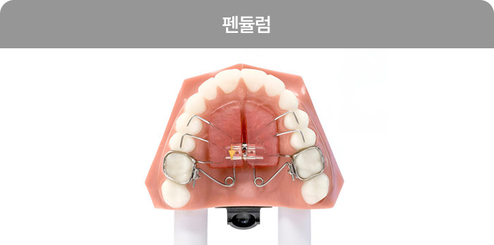 펜듈럼
