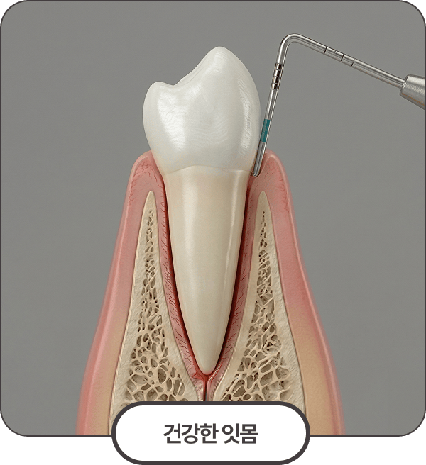 건강한 잇몸